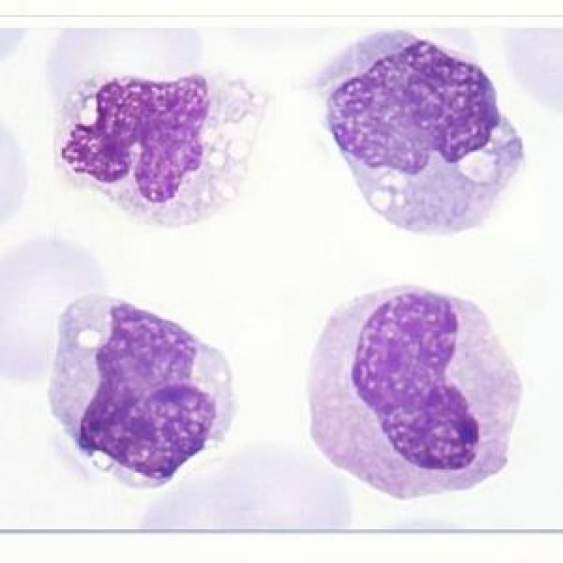 O Monocito - Hemoclass - Hematologia e Medicina Diagnóstica