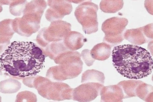 Anomalia de Alder Reilly