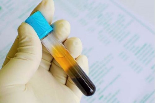 Coagulograma para Laboratorios de Pequeno e Medio Portes