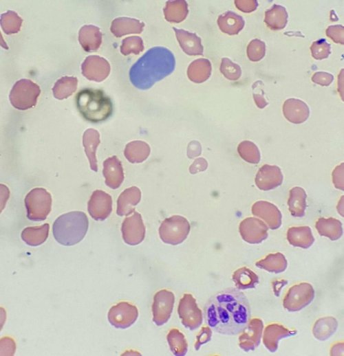 Hematologia Basica Terceira Aula