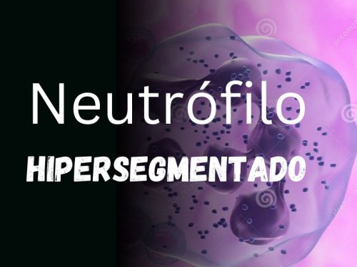 Neutrofilo Hipersegmentado