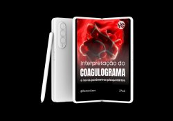 Interpretao do Coagulograma e Novos Parmetros Plaquetrios