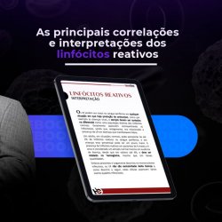 Linfcitos Reativos para Analistas Clnicos